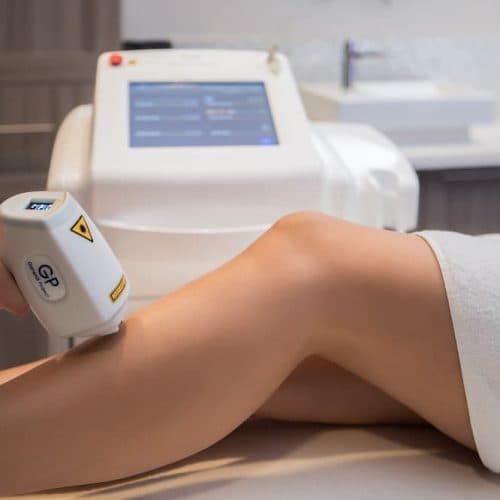 Laserska epilacija diodnim laserom — Studio Revive Beograd